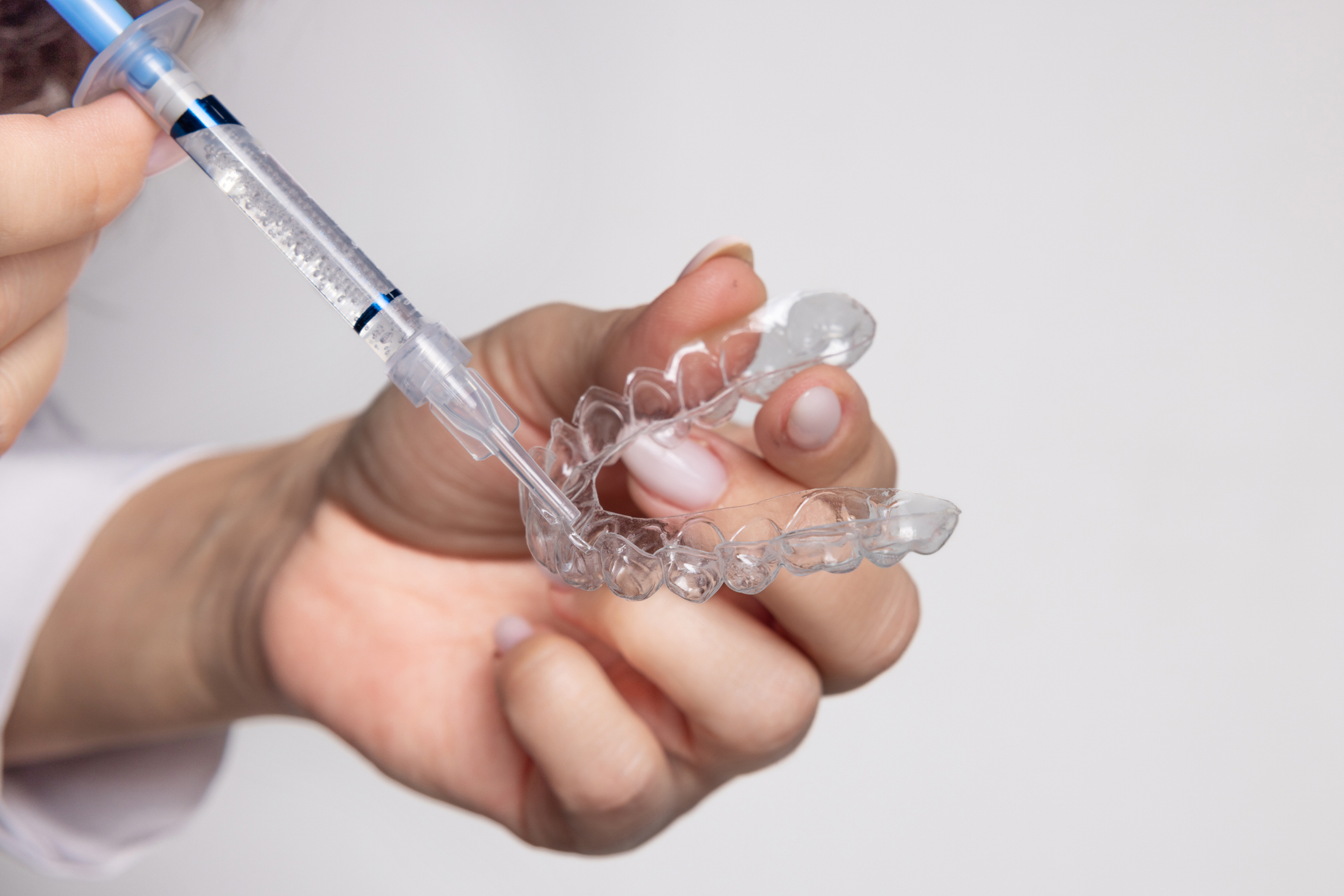 Why choose professional whitening over DIY kits