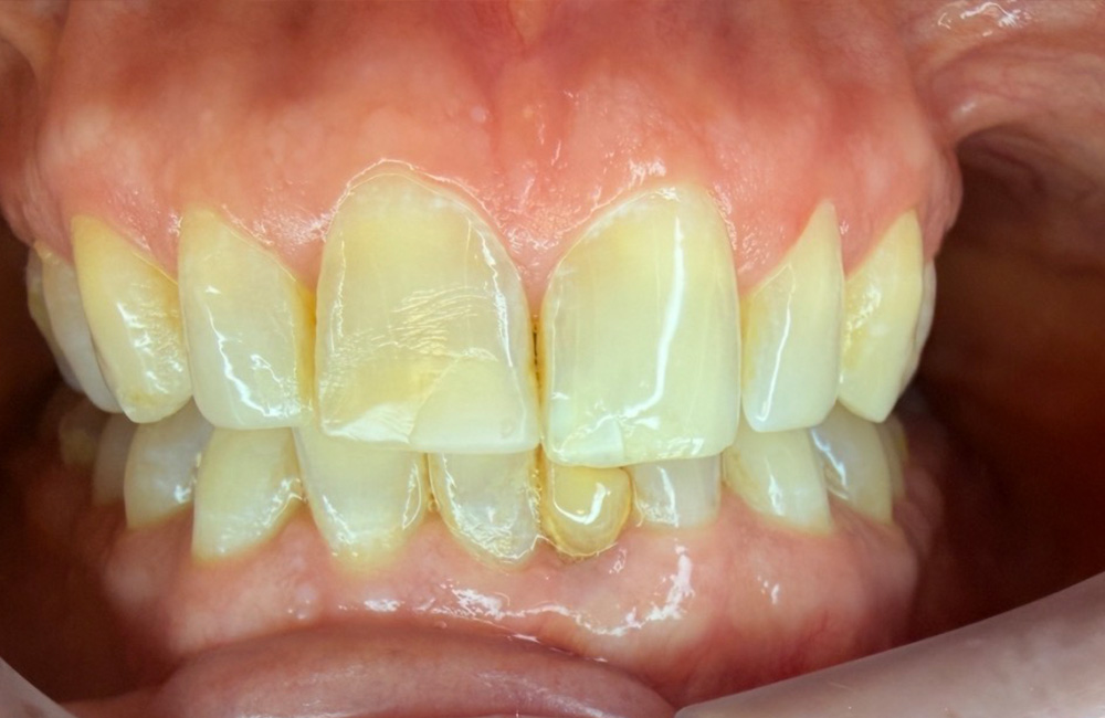 after image