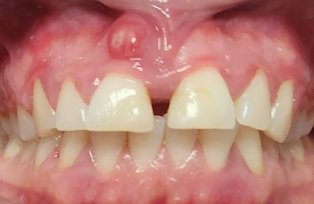 before image