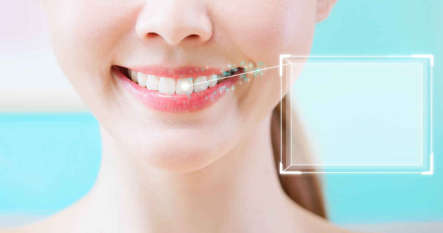 What is digital smile design – close-up of a smile with a digital scan overlay planning treatment
