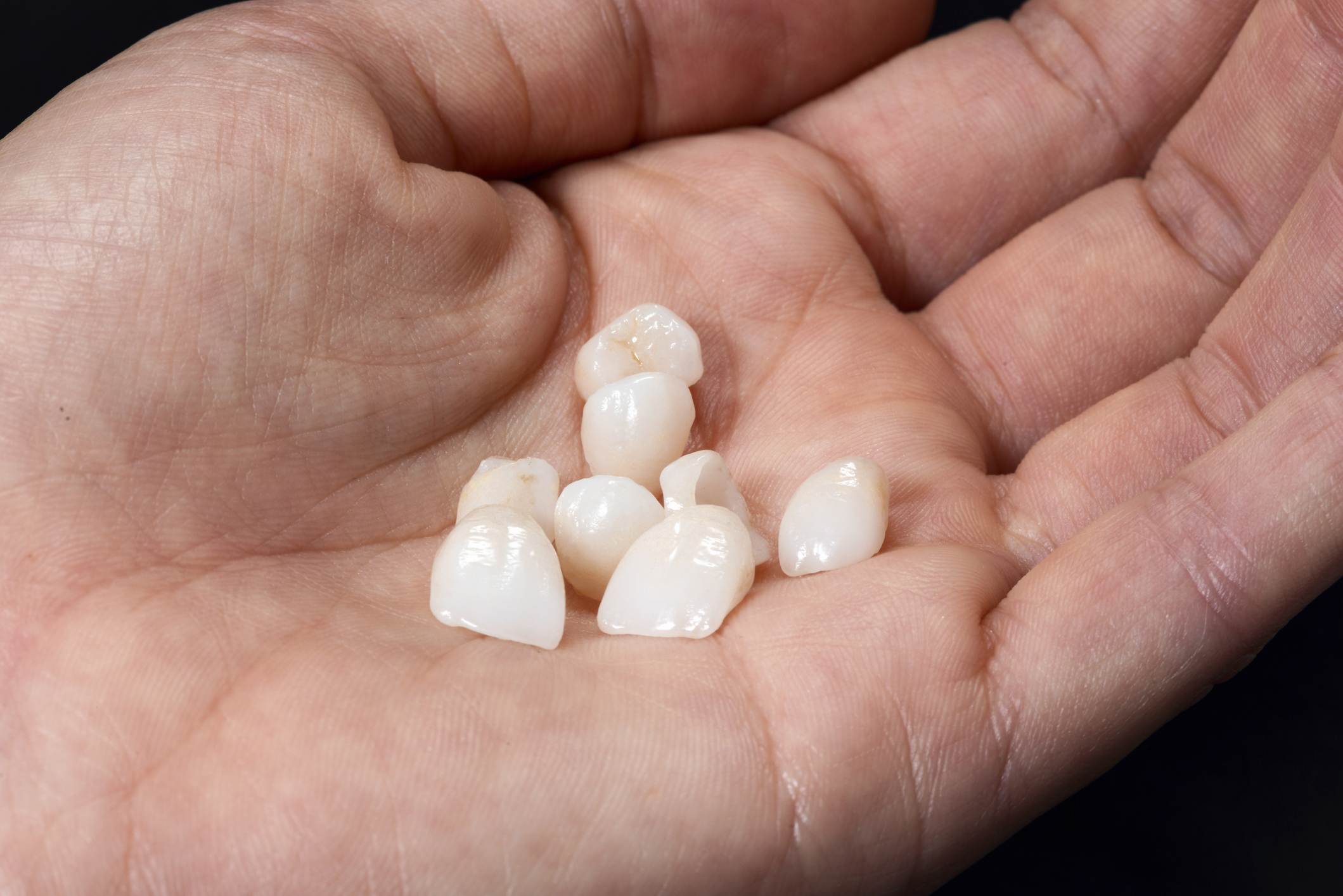 Dental veneers on male hand, closeup photo